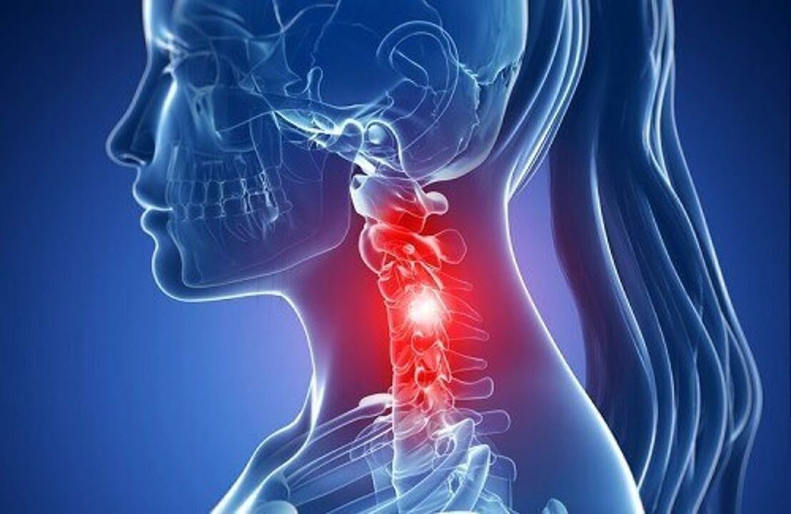 cervical spine pain