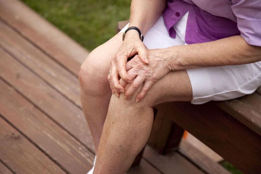 Knee osteoarthritis is common in older women