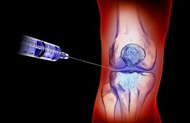 The treatment plan for the knee joint osteorosis