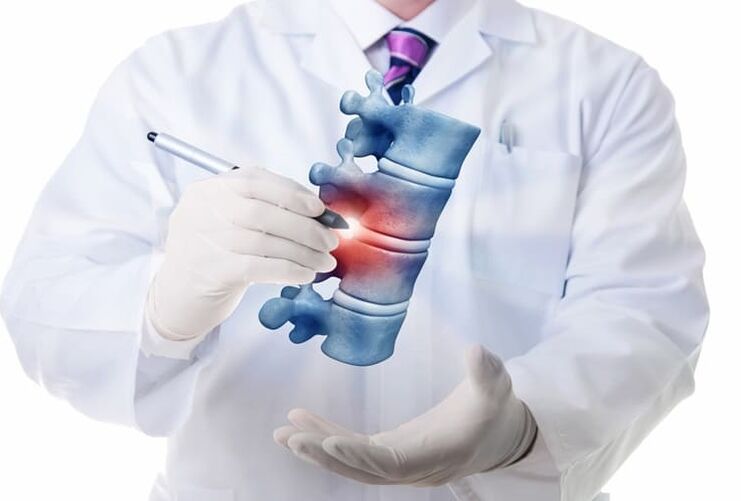 Spinal injuries due to thoracic osteochondrosis.