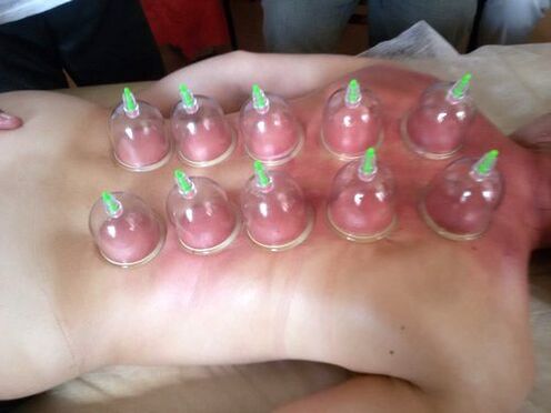 Cupping is a great way to treat lower back pain at home
